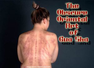 Gua Sha image